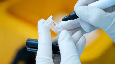 коронавирус, фото - Новости Zakon.kz от 19.10.2022 01:42