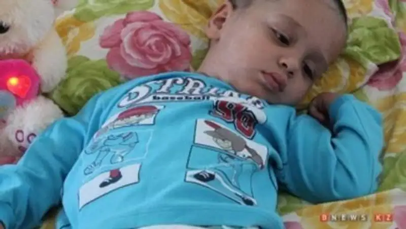 В Актау ребенок, на которого упал телевизор, потерял зрение