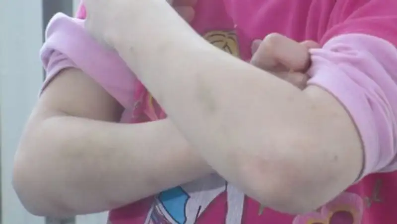 Трагедия в Актобе: что известно о родной матери избитой девочки 