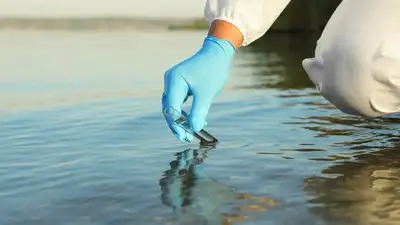 ВОЗ: более миллиарда людей могут заразиться холерой, фото - Новости Zakon.kz от 26.02.2023 11:51