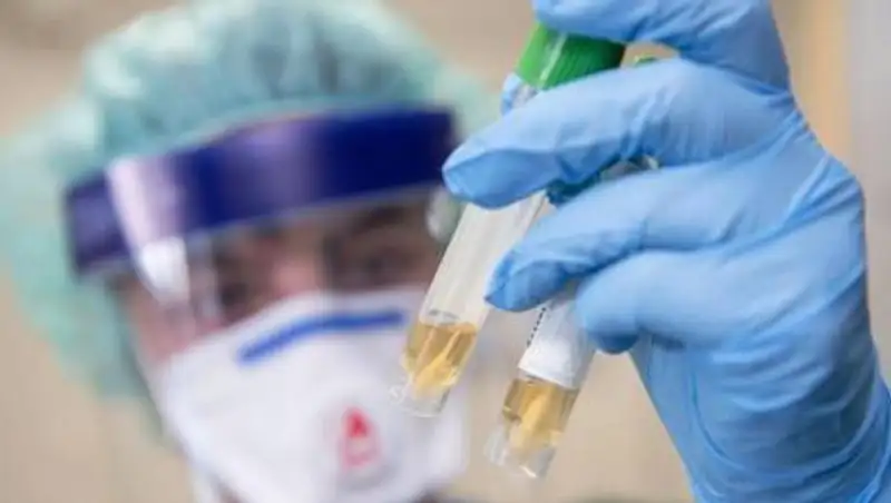 Число умерших от коронавируса казахстанцев достигло 3535