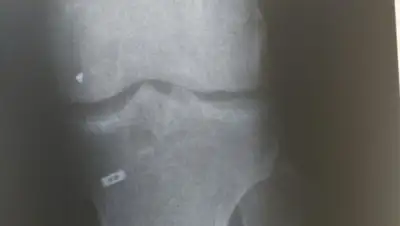 Ерлан Тайкулаков, фото - Новости Zakon.kz от 18.04.2018 11:05