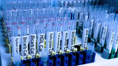 pxhere.com, фото - Новости Zakon.kz от 02.04.2020 23:19