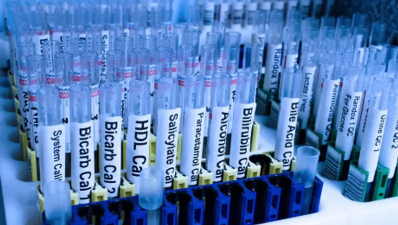 Число заболевших коронавирусом в РК выросло на 12 человек