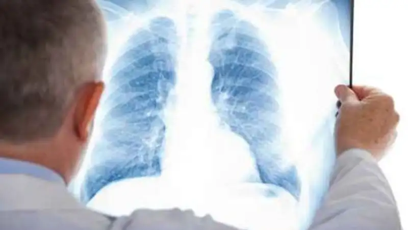 Туберкулез в открытой форме обнаружен у ученика 4 класса