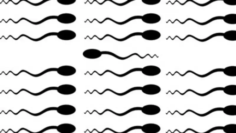 Во Франции впервые вырастили искусственную сперму человека