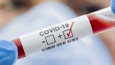 dw.com, фото - Новости Zakon.kz от 02.04.2020 10:55