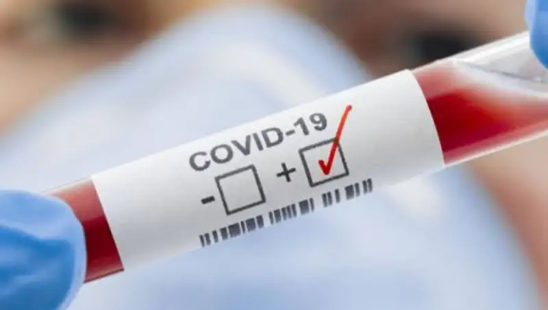 Житель Тараза заразился коронавирусом в поезде