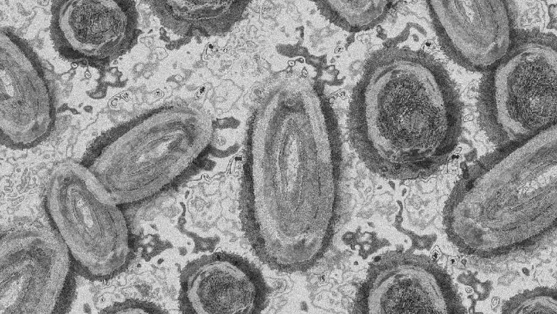 Оспу обезьян обнаружили у двоих подростков в Германии