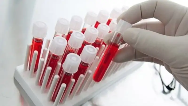 Родители умершего от менингита ребенка госпитализированы в Талдыкоргане