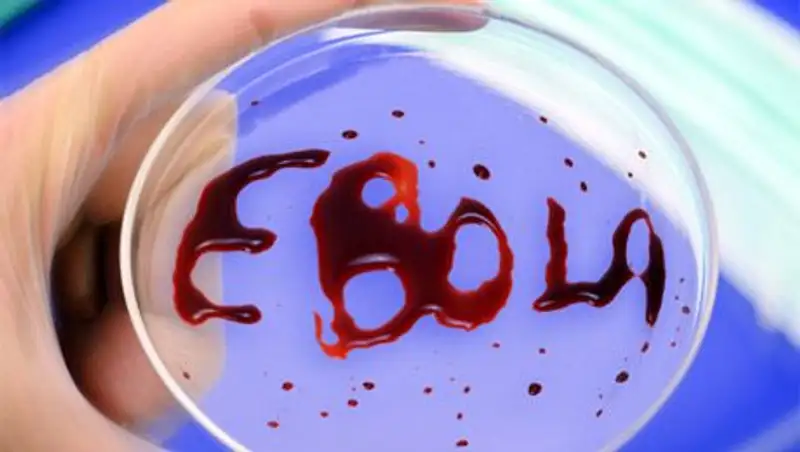 Медики из Таиланда объявили, что нашли вакцину против вируса Эбола и вскоре ее представят