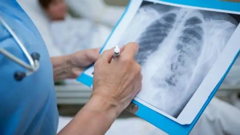 Озвучена статистика по летальным случаям от COVID и пневмонии в Казахстане