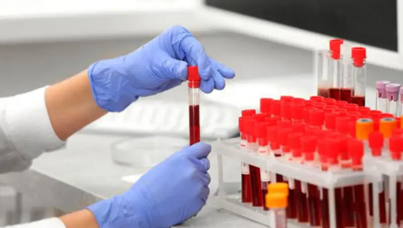 "Олимп" не будет проводить ПЦР-тесты на коронавирус в Нур-Султане и Алматы 19-21 июня