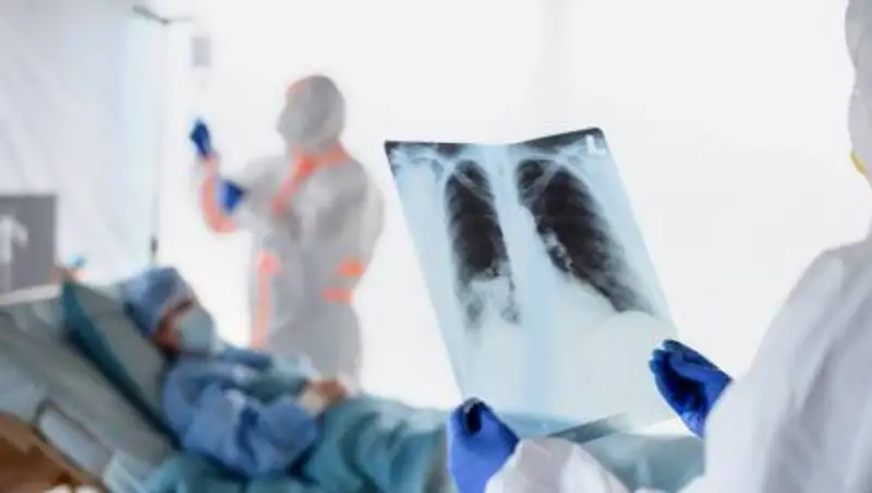 172 новых случаев пневмонии с признаками коронавируса зафиксированы в Казахстане