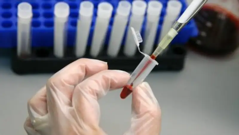 Бекшин: С установлением солнечной погоды заболеваемость менингитом в Алматы пойдет на спад