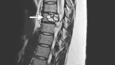 The New England Journal of Medicine, фото - Новости Zakon.kz от 16.07.2018 21:54