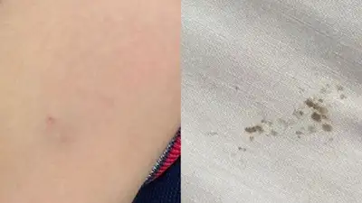 Пострадавший ребенок , фото - Новости Zakon.kz от 05.12.2022 20:01