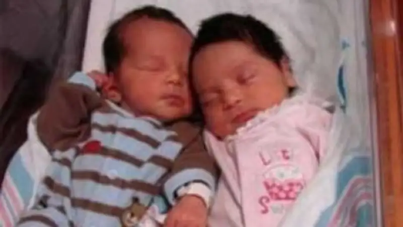 Англичанка, обладающая двумя матками, родила здоровых близнецов