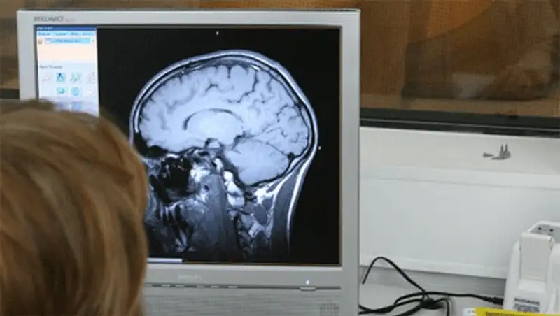 Ученые: во время сна мозг очищается от токсинов, фото - Новости Zakon.kz от 21.10.2013 00:24