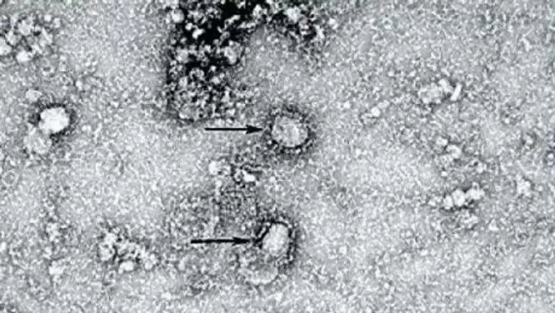 Опубликовано фото нового коронавируса