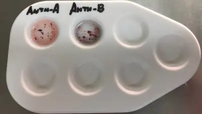 anest-rean.ru, фото - Новости Zakon.kz от 19.06.2020 23:02