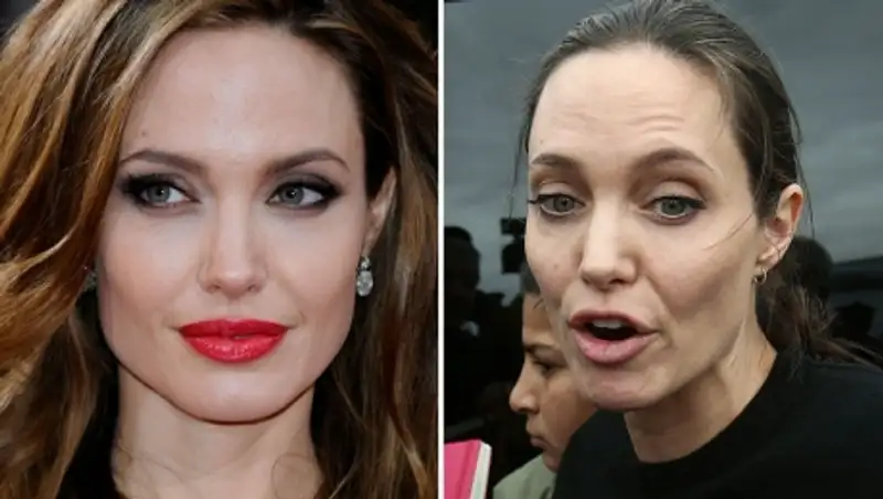 СМИ: Анджелина Джоли умирает в больнице от потери веса и рака