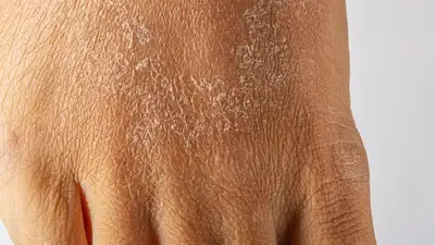 Врач рассказала, дефицит каких витаминов вызывает сухость и старение кожи, фото - Новости Zakon.kz от 01.04.2023 14:52