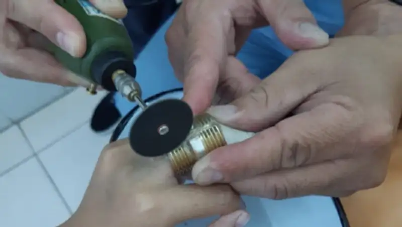 Врачи в Актау спилили муфту с пальца ребенка