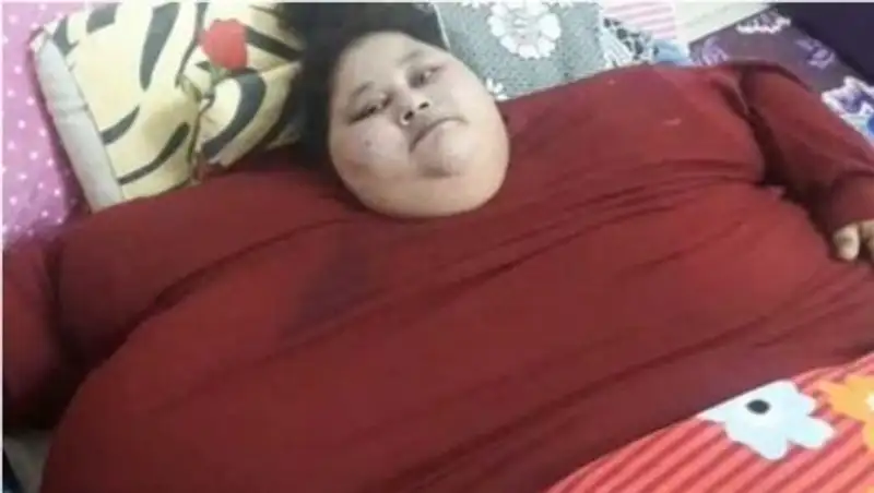 Самую толстую женщину в мире привезли на лечение в Индию