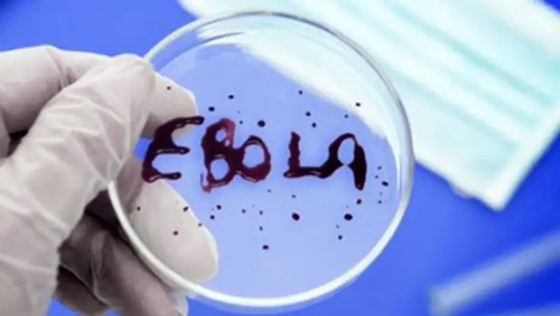 В Казахстане не требуется создания спецструктуры по борьбе с Эболой - Минздрав