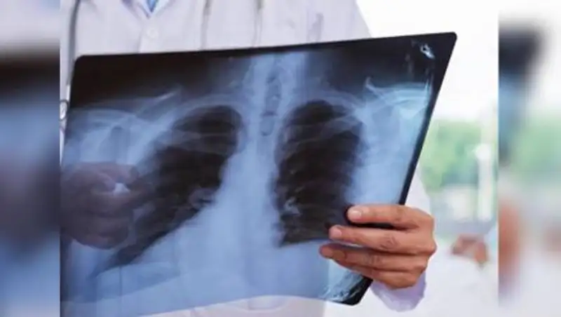 За сутки в Казахстане выявили 232 новых случая пневмонии