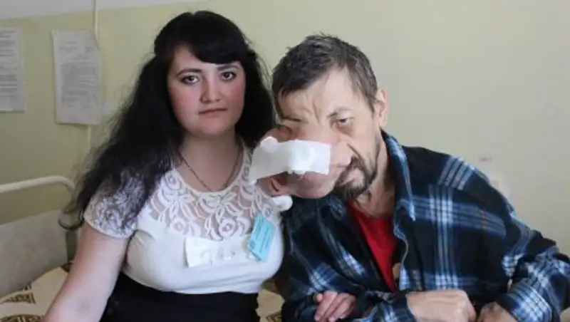 За лечение мужчины с ужасающей опухолью взялись костанайские врачи