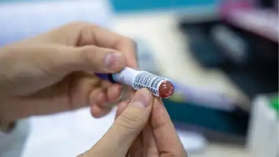 анализ, фото - Новости Zakon.kz от 20.08.2022 22:17