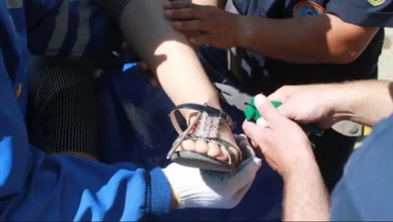 В Уральске торчащая арматура проткнула девочке ногу