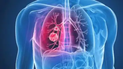 zen.yandex.ru, фото - Новости Zakon.kz от 08.01.2020 09:26