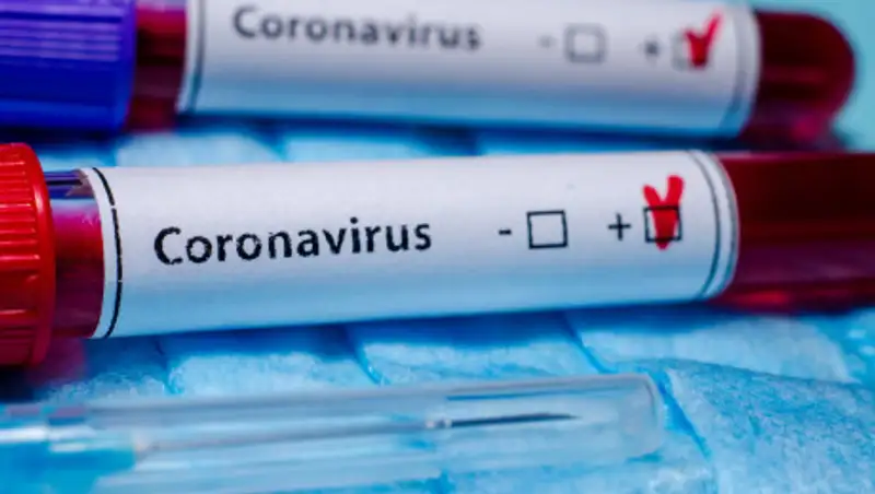 В Казахстане выявлены еще 37 случаев заражения COVID-19