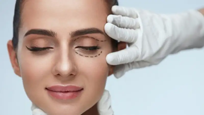 Блефаропластика: не только для красоты, но и для здоровья