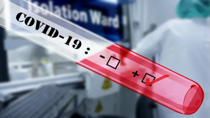 Россия ответила на критику Лукашенко по поводу тестов на COVID