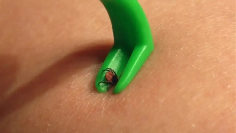 С начала весны в РК зарегистрировано пять случаев клещевого энцефалита