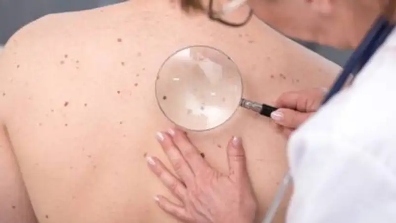 На какую проблему со здоровьем указывают красные родинки