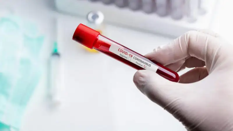 Диагноз коронавирусной инфекции подтвержден у 3 920 казахстанцев