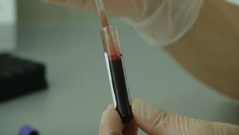 В Алматы выздоровел еще один человек от коронавируса