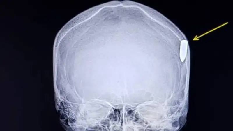 Военная полиция опровергла слух об упавшем на пулю солдате