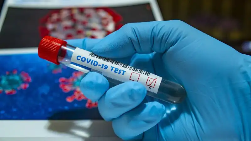 Заболеваемость COVID-19 в Казахстане продолжает расти