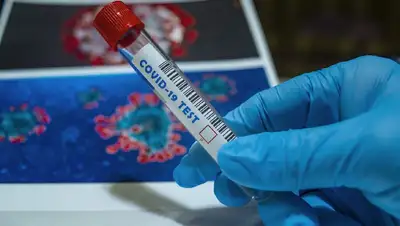 коронавирус, заболели, тест , фото - Новости Zakon.kz от 31.05.2022 10:08