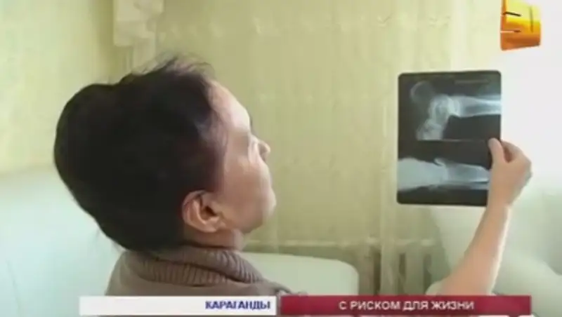 Жительница Караганды получила травму в городском автобусе