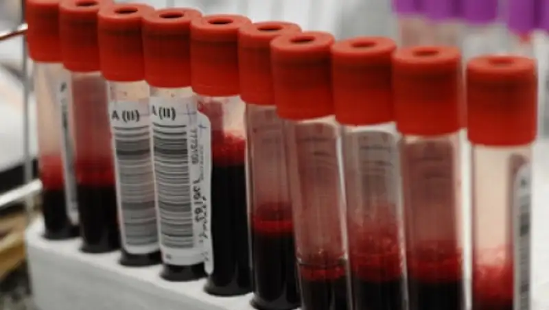 В Восточном Казахстане будет создан банк редких групп крови на случай ЧС