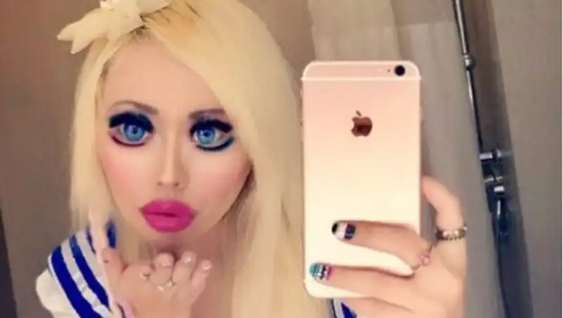 Китаянка разрезала глаза, потратив $35 тыс., чтобы выглядеть по-европейски