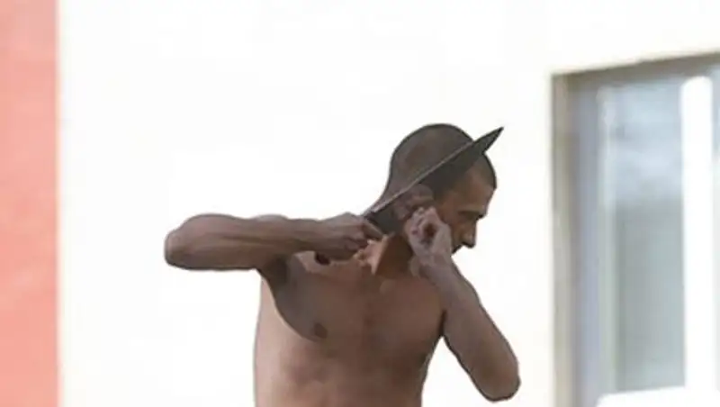 Российский художник Петр Павленский отрезал себе мочку уха