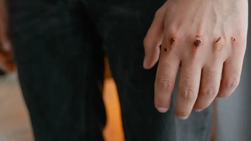 Массовую драку устроили посетители кафе в Жетысуской области